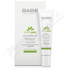 BAB Stop AKN kontrol gel 8ml